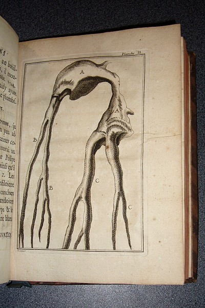 Observations anatomiques tirées des ouvertures d'un grand nombre de cadavres, propres à découvrir les causes des maladies et leurs remèdes (1753)