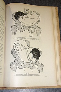 Obstétricie pratique