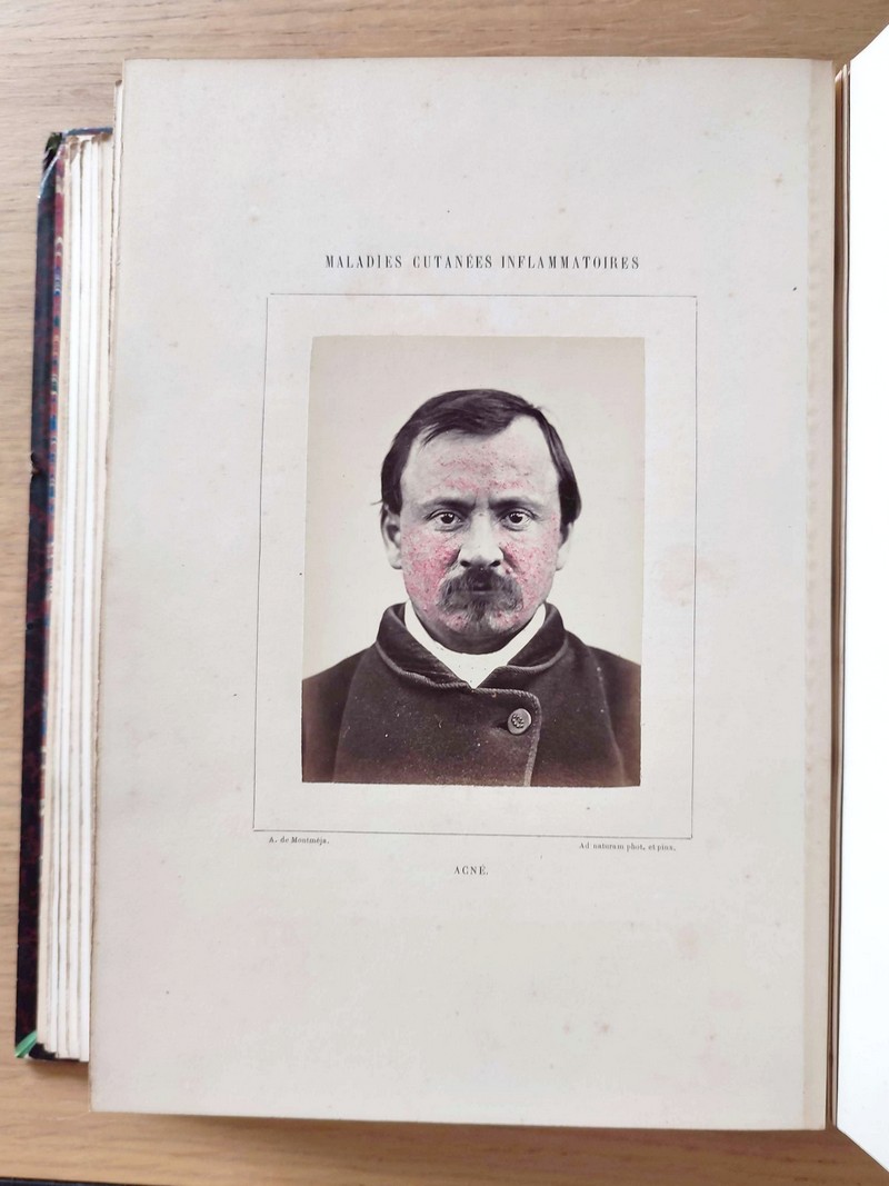 Clinique photographique de l'Hôpital Saint-Louis