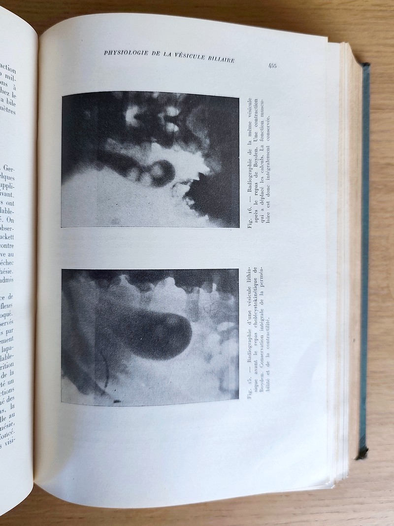 Physiologie du foie et de l'appareil urinaire. Tome III du Traité de physiologie normale et pathologique